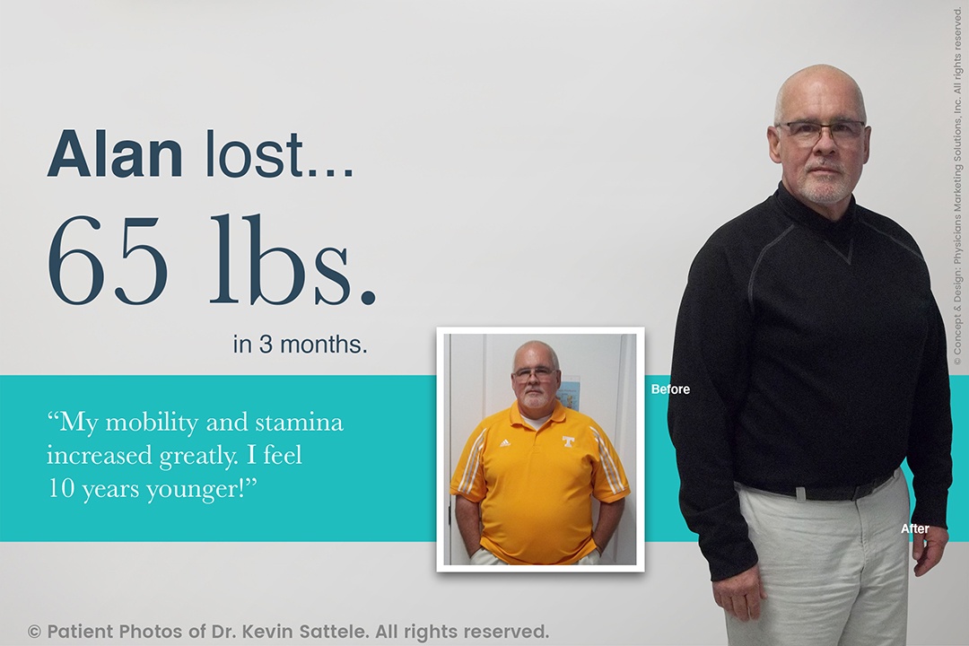 Alan lost 65 lbs. in 3 months